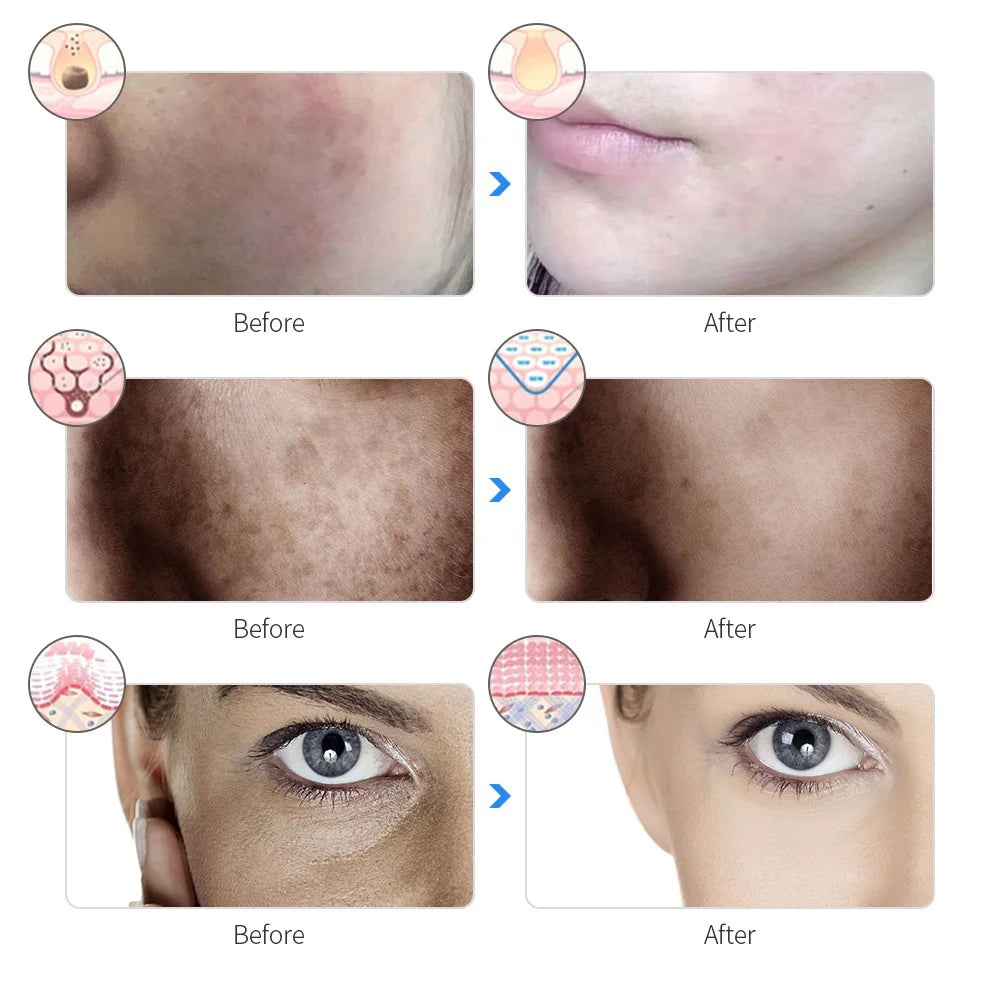 Máscara LED Facial Profesional — Terapia de Luz para Piel Radiant